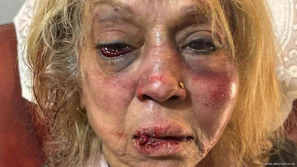 Girrawheen bashing: Elderly woman allegedly battered unconscious in home invasion in Perth- as released immigration detainee is one of four arrested