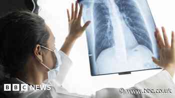 Rare lung disease centre to give patients 'hope'