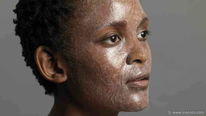 Everything Black Women Should Know About Chemical Peels