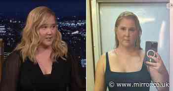 Amy Schumer gets candid about her 'puffy face' caused by hormonal disorder Cushing's syndrome