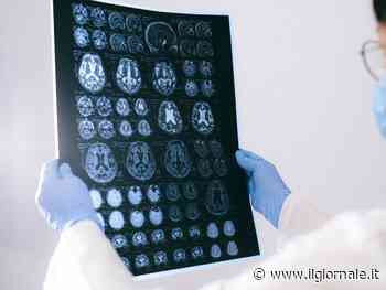 Alzheimer, un gene potrebbe proteggere il cervello: lo studio