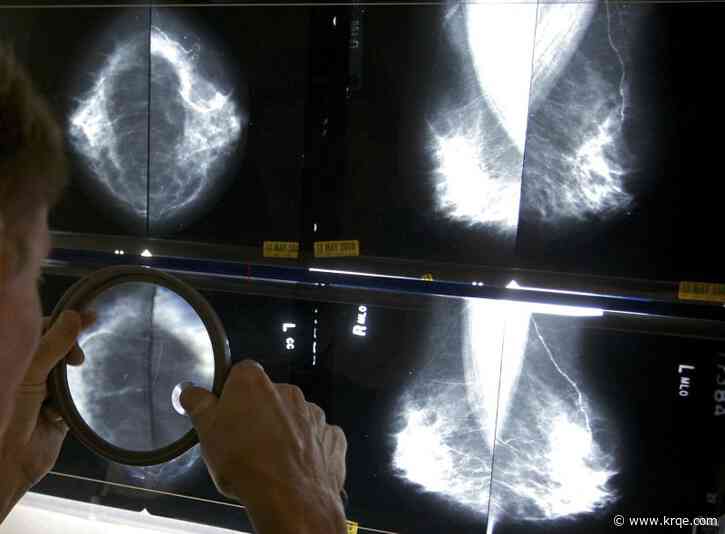 Mammograms should start earlier amid rising breast cancer rates, panel says