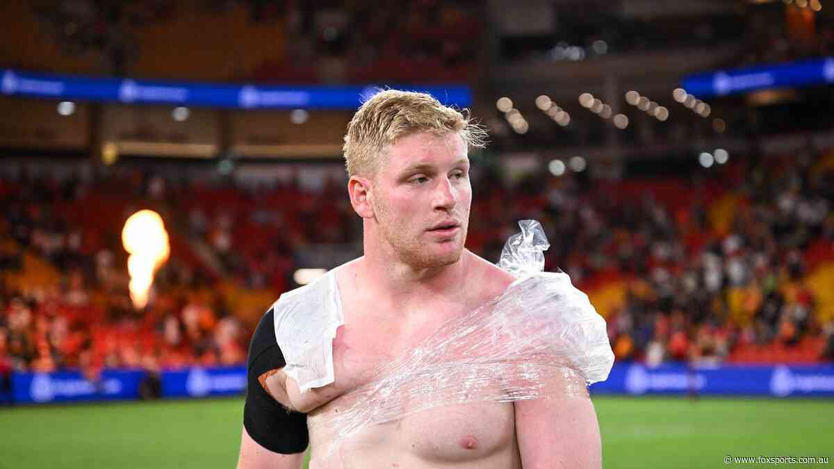 Star prop suffers injury setback in huge Dolphins and Maroons blow — Casualty Ward     
