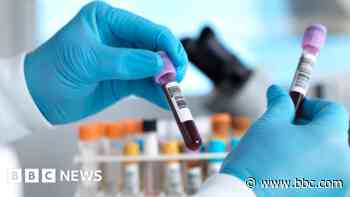Hundreds protest over blood tests cut