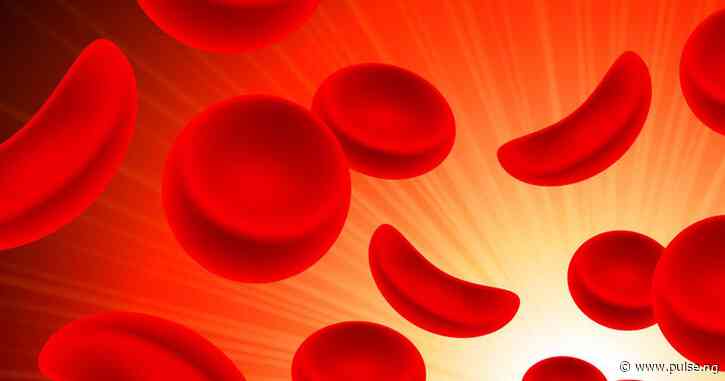 Voxelotor, new drugs for people with sickle cell disease to live longer