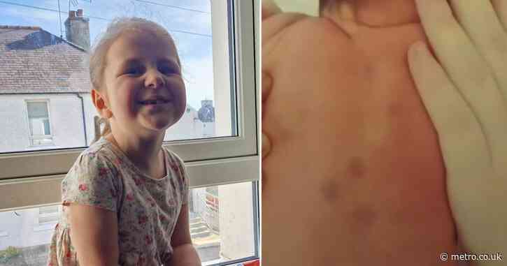 Purple spots found on girl, 6, turned out out to be two forms of cancer