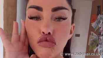 Katie Price shows off her VERY dramatic pout after getting more lip filler and insists she won't stop: 'I want to look like a Bratz doll'