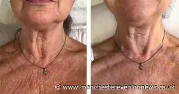 Marks and Spencer shoppers hail award-winning anti-wrinkle cream for sagging necks perfect for anyone who wears summer dresses