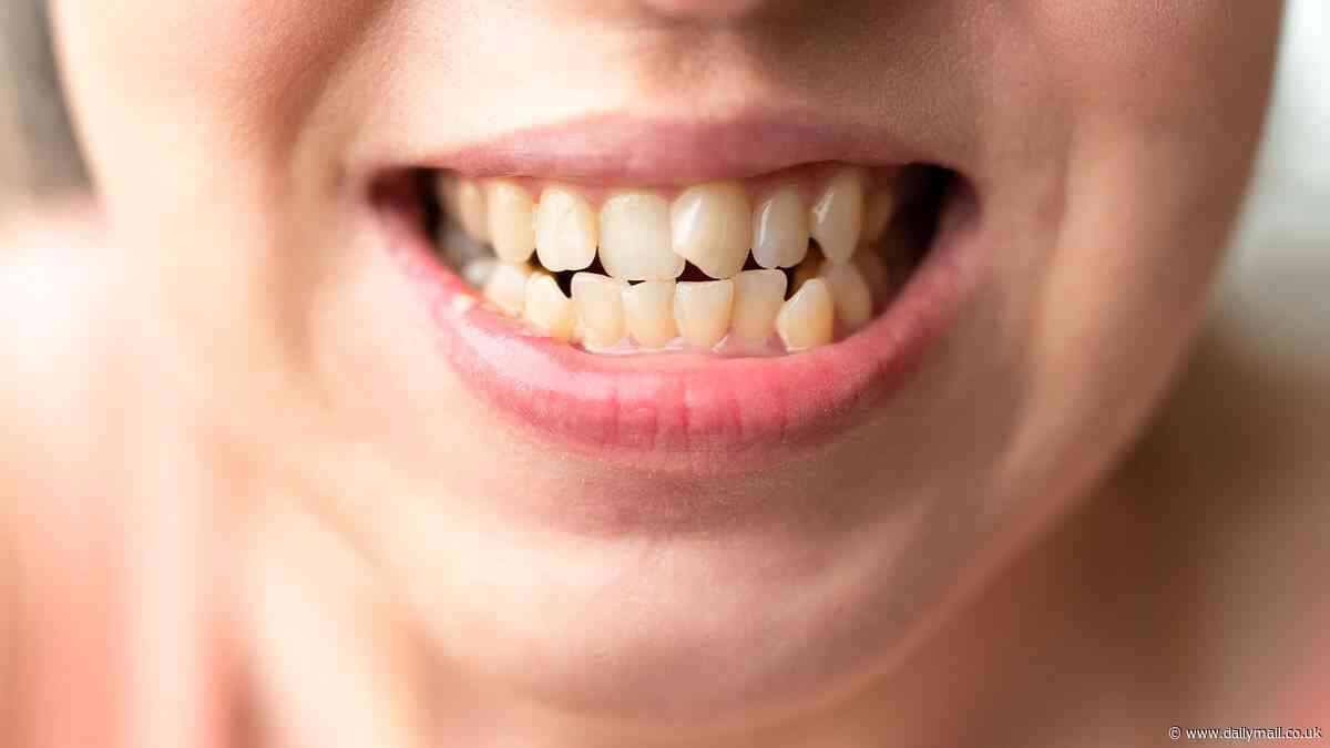 People who lose their teeth from poor oral hygiene more likely to suffer chronic back pain, new research shows