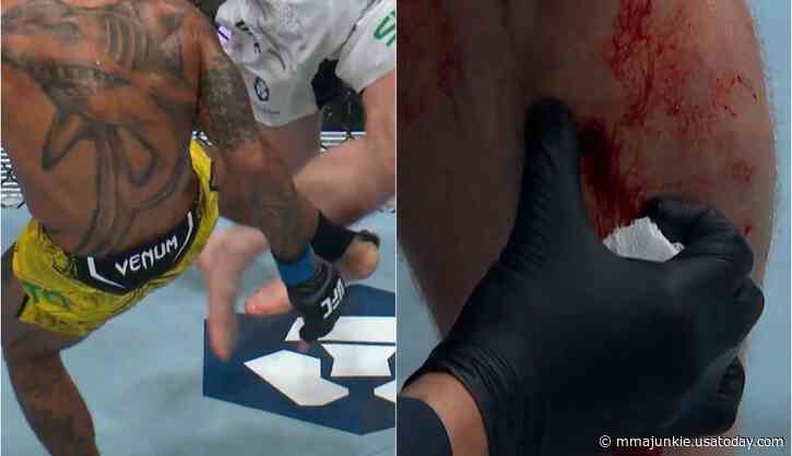 UFC 301 video: Joanderson Brito slices Jack Shore's shin with leg kick to earn stoppage win