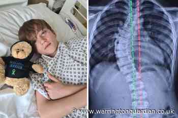 Orford teen who had 53-degree spine curve bounces back after surgery