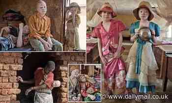 Hunted down by witchdoctors and sold by their own families: The albinos of Tanzania driven from their homes and forced to live in hiding for fear of being hacked to pieces by shamans who believe their body parts 'bring luck'