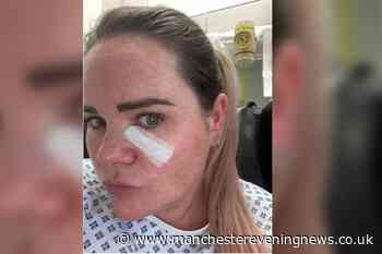 Nurse knew it was serious after spotting unusual spot under her eye