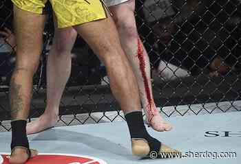 Coach: Jack Shore Didn’t Sustain Fracture in Doctor Stoppage Loss at UFC 301