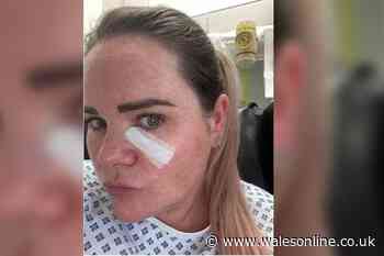 Nurse knew tiny 'little' spot on her face was gravely serious