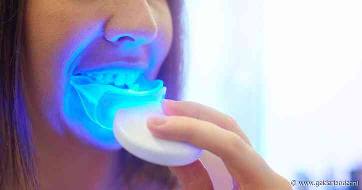 Zo veilig is zelf je tanden bleken: ‘Mits gel en bleeklepel verkregen zijn bij de tandprofessional’