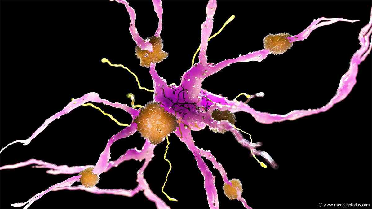Alzheimer's Variant May Cause Distinct Form of the Disease