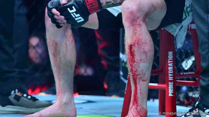 UFC 301 medical suspensions: Four fighters receive 180 days but not Jack Shore for leg wound