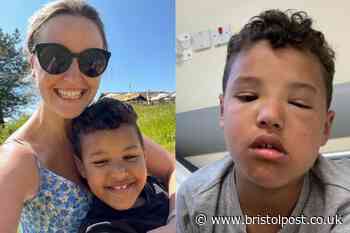 Parents call for urgent change as boy could have died eating burger