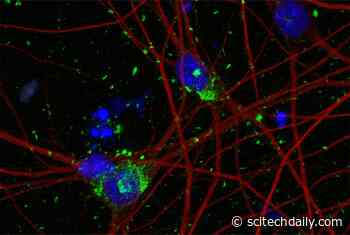 Revolutionizing Alzheimer’s Research: Cornell Scientists Develop Groundbreaking Neuron Model