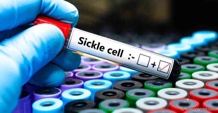 Black 12-Year-Old Patient Begins New Sickle Cell Therapy Treatment