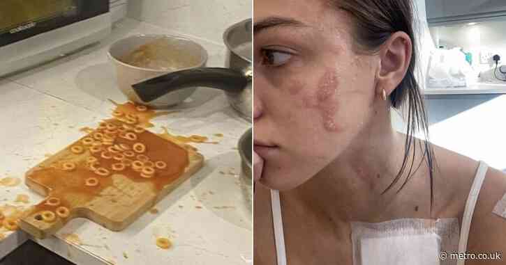 Woman’s face suffers burns after ‘Heinz spaghetti hoops explode in her face’