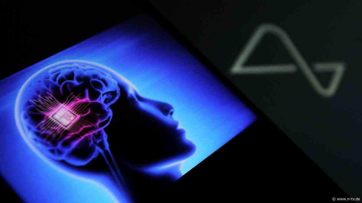Elektroden lösen sich: Musks Neuralink räumt Probleme mit Gehirnimplantat ein