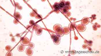 Pilzinfektion: Candida auris breitet sich immer mehr aus