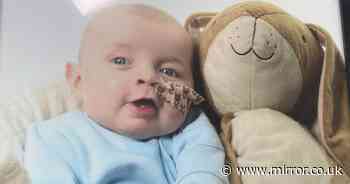 Parents plea for treatment as baby is 'only one in UK with fatal rare condition'