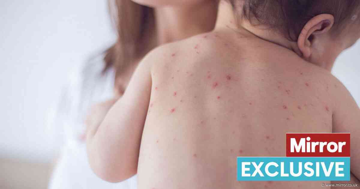Measles emergency warning as cases this year already dwarf those in whole of 2023