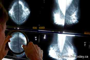 Breast cancer screening should start at age 40, Canadian Cancer Society says