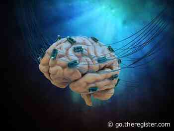Brain-sensing threads slip from gray matter in first human Neuralink trial