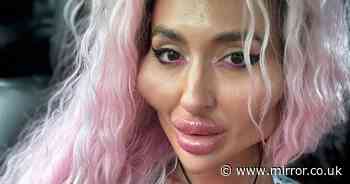 Woman with 'world's biggest cheeks' shows how she looked at 26 – before filler