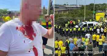 Leeds fan 'slashed in neck' outside Carrow Road after Norwich play-off semi-final