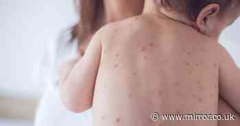Measles jab 'more than twice as likely not to work in children born by C-section'