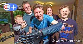 Leben mit Prothese: Der Papa mit der leuchtenden Roboterhand