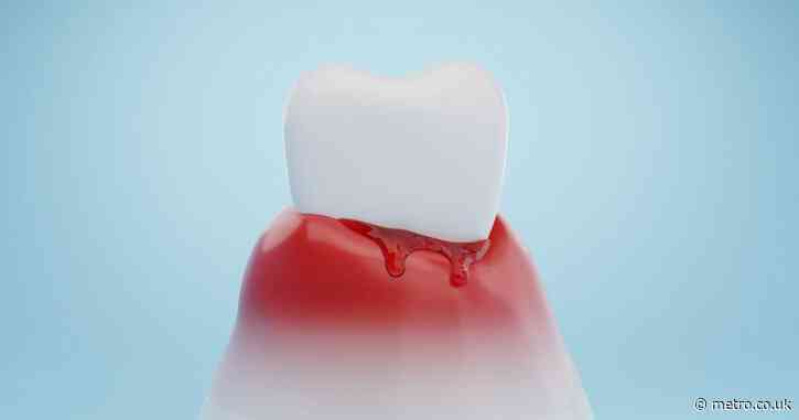 Gum disease can wreak havoc on your sexual health