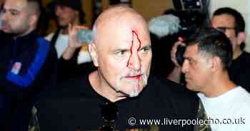 Tyson Fury's dad injured in pre-fight brawl ahead of Oleksandr Usyk showdown