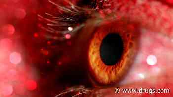 Study Identifies Factors Associated With Hydroxychloroquine Retinopathy