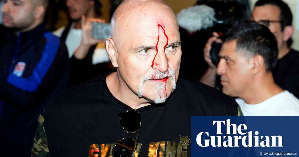 Tyson Fury’s father left bloodied after clash with member of Usyk’s entourage