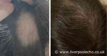Shoppers swear by £15 'game changing' hair growth oil even hairdressers comment on