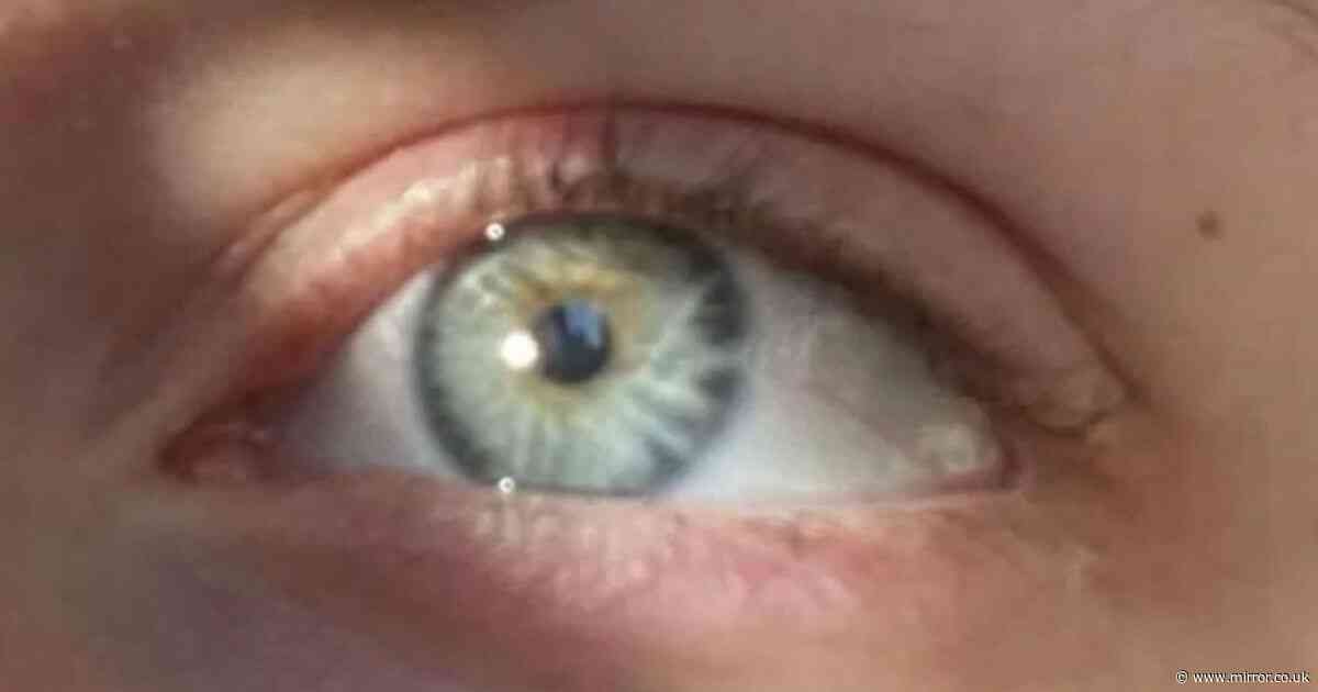Person baffles with photo of their eye – as people can't agree on the colour
