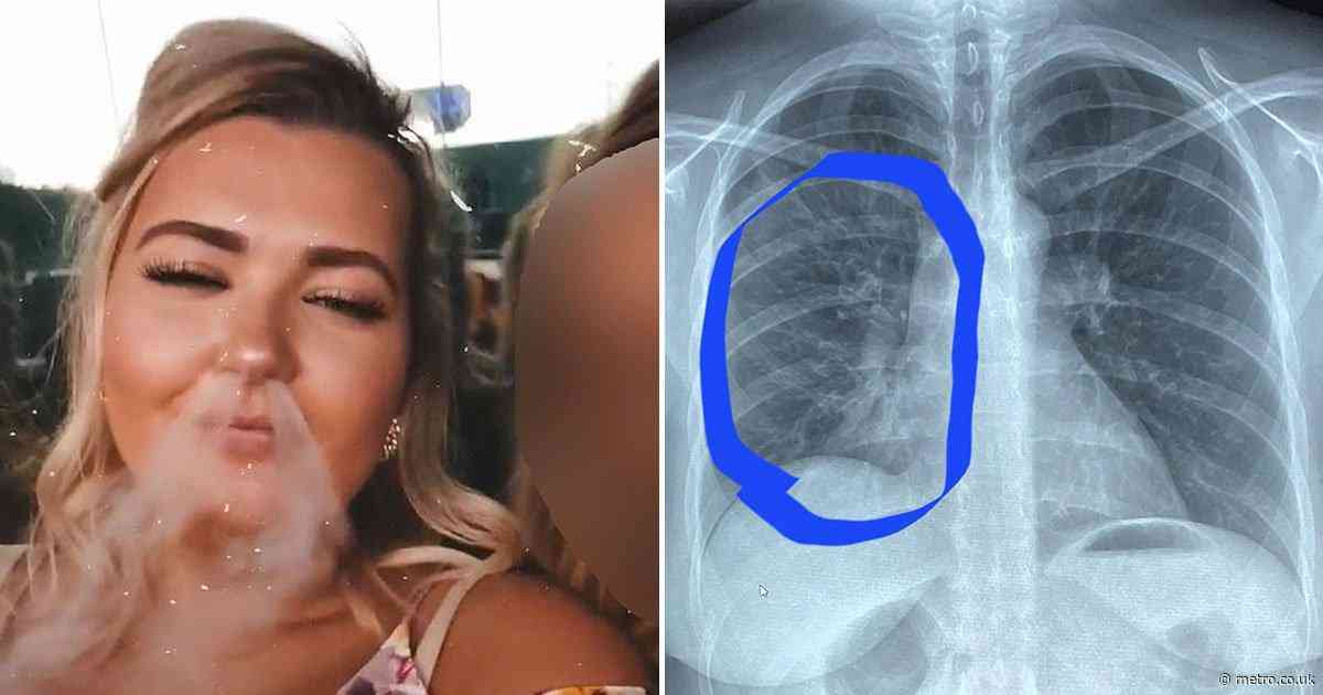 Woman nearly died as lungs ‘popped like hot fried chicken’ from vaping