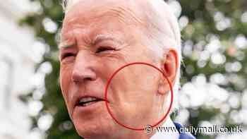 Man with same sleep disorder as Joe Biden causes four traffic accidents in months: Wake up call!