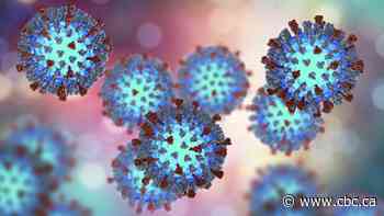 Ontario measles cases approaching high set a decade ago