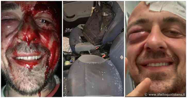 Chef Rubio picchiato sotto casa: “Mi hanno aspettato in sei per massacrarmi, sono i terroristi sionisti”