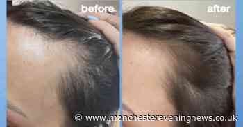 Shoppers swear by £29 'amazing' hair growth serum which gives 'thickening' results in 6 weeks