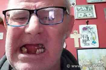 Man 'roaring' in pain pulls out his own teeth with pliers despite risk of infection