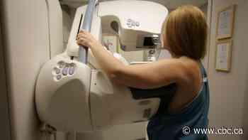 Advocates hope Alberta will follow new guidelines, lower breast cancer screening age to 40