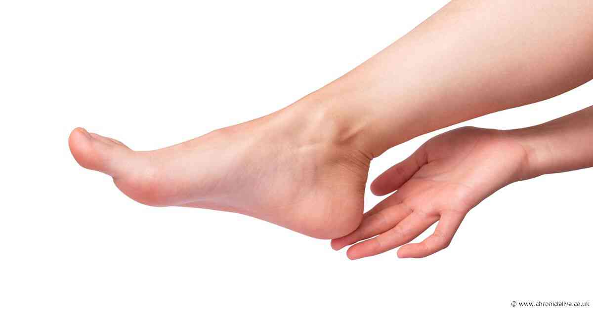 Podiatrist issues brutal warning over new viral foot peeling trend